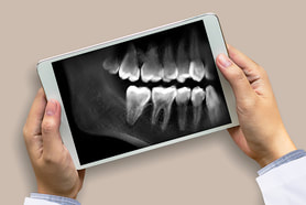 Why didn't your X-ray show your tooth decay?